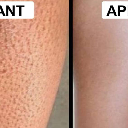 L'exfoliation